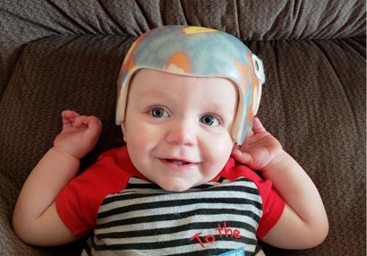 Plagiocephaly Awareness: 3 Reasons to spread the word!
